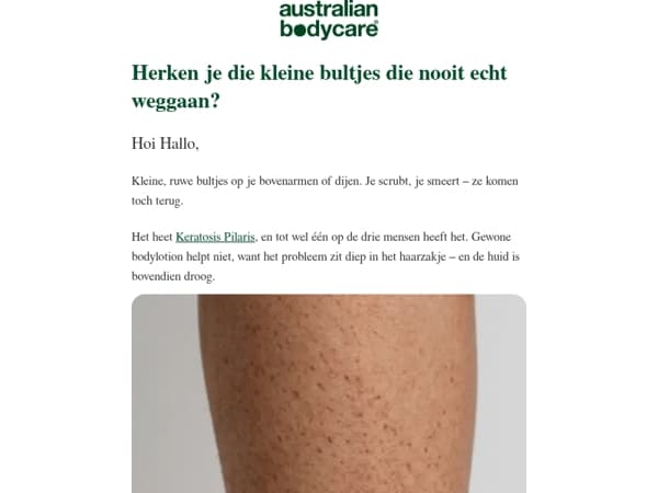 Hallo, je bovenarmen proberen je iets te vertellen + cadeau t.w.v. € 27,98 👀👀